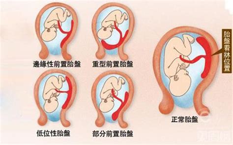 胎盤母體面